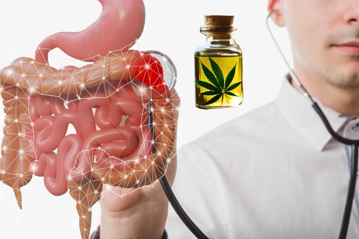 How CBD Takes on Colorectal Cancer with a Vengeance
